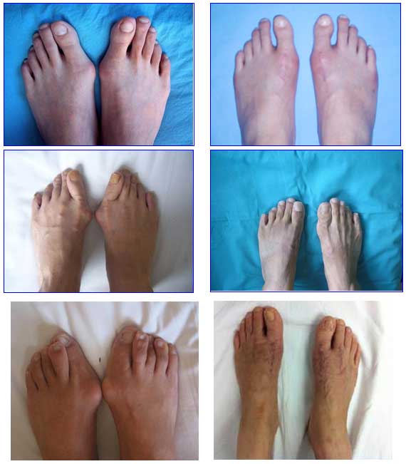 目前手足外科开展的手术