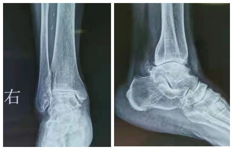 initpintu_副本.jpg initpintu_副本.jpg